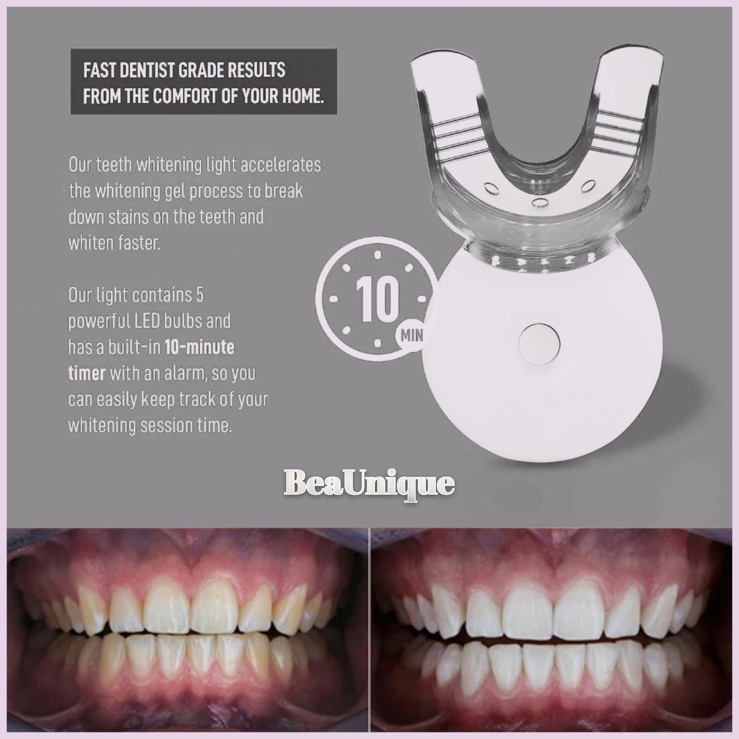 BeaUnique Teeth Whitening Home Kit